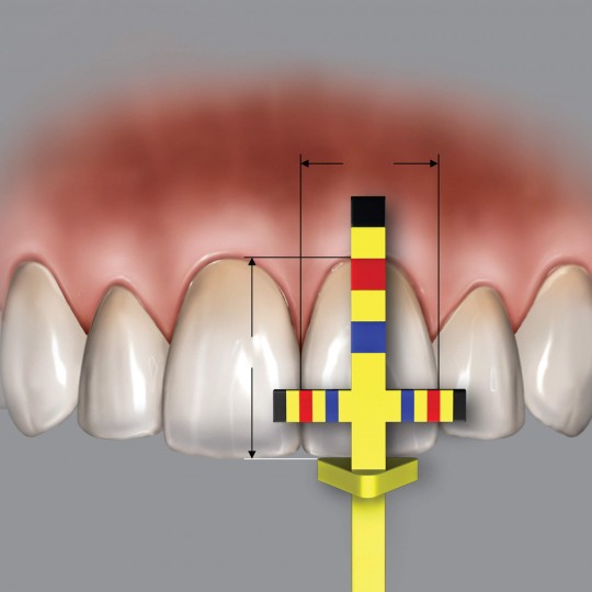PROPORTION GAUGE DR.