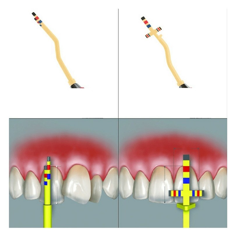 PROPORTION GAUGE DR.