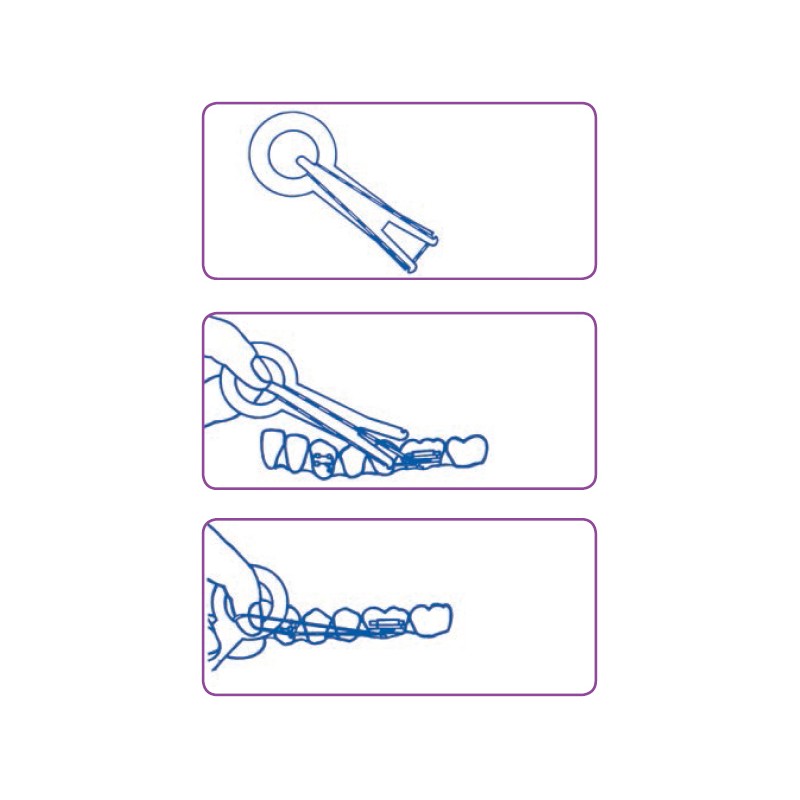 APPLICATORI per ELASTICI