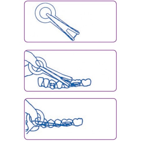 INTRAORAL ELASTIC APPLICATOR INTRAORAL ELASTIC APPLICATOR