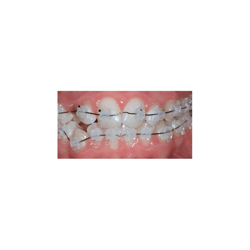 KIT ATTACCHI DB ROTH STEP 022 - ESTETICI - 1 CASO