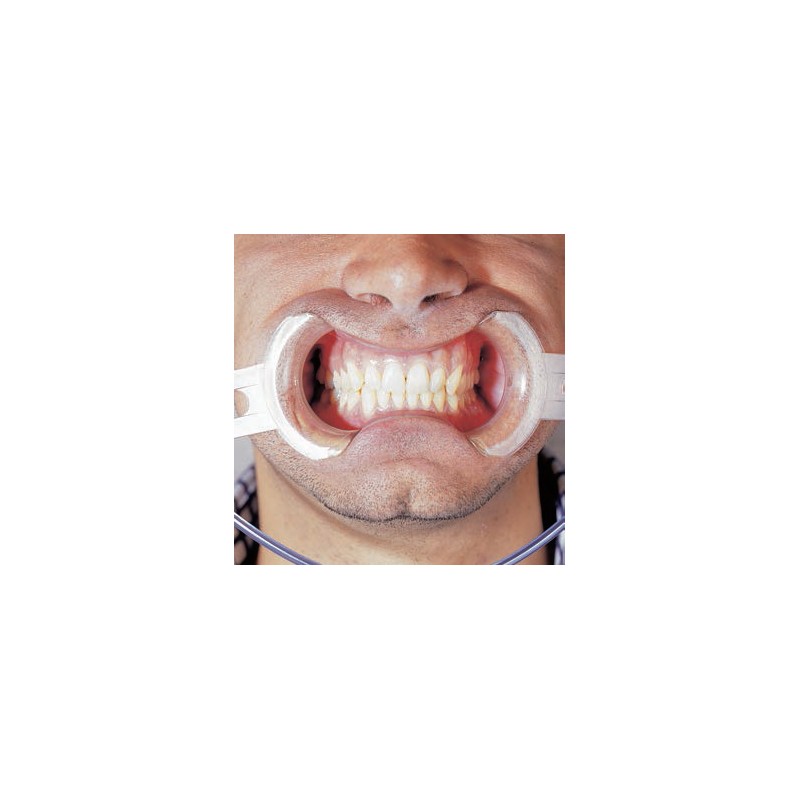 KIT APRIBOCCA KIT APRIBOCCA