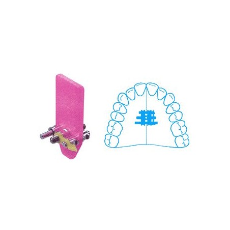 VITI A TRAPEZIO VITI A TRAPEZIO