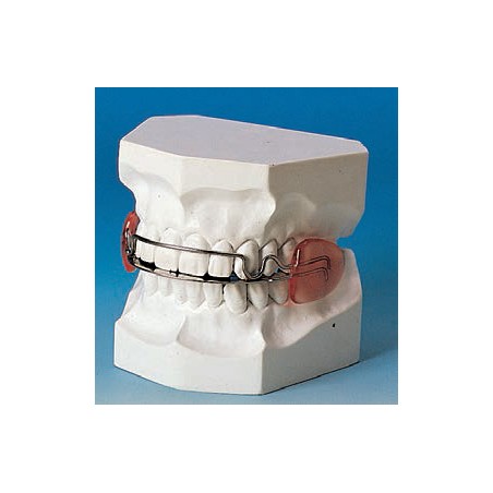 LATERAL PLATES