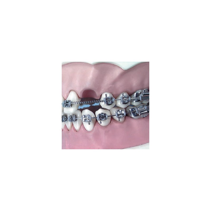 MOLLE APERTE 009 X 036 MOLLE APERTE 009 X 036