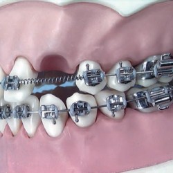 MOLLE APERTE 012 X 030