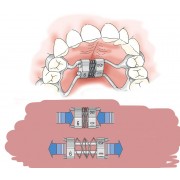 DENTE/MOLLA Filo ø 8,5 - UNI - Ricambi Agricoli - Foto 7