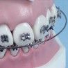 ARCHI NiTi Tondi Superiori e Inferiori forme small medium large