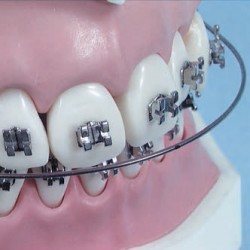 ARCHI NiTi MEMORIA rettangolari Superiori e Inferiori di forma