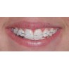 ATTACCHI D.B..022 CERAMICI 1pz