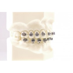 AUFSÄTZE D.B. DIAGONAL RUND