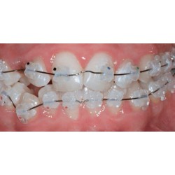 ATTACCHI D.B..022 ESTETICI DI COPOLIMERO MICRORIEMPITO 10pz