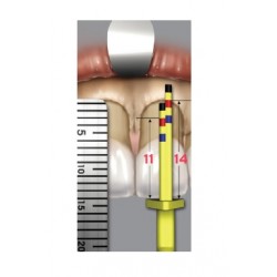 CROWN LENGTHENING GAUGE DR.