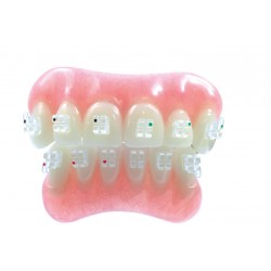 D.B. MBT EISBINDUNG KIT