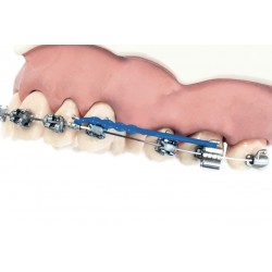 ZWEIDIMENSIONALE BETASPEICHERBÖGEN