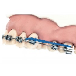 ZWEIDIMENSIONALE BETASPEICHERBÖGEN