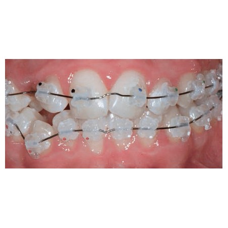 ATTACCHI D.B..022 ESTETICI DI COPOLIMERO MICRORIEMPITO 10pz