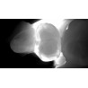 DIAGNOCAM VISION FULL HD
