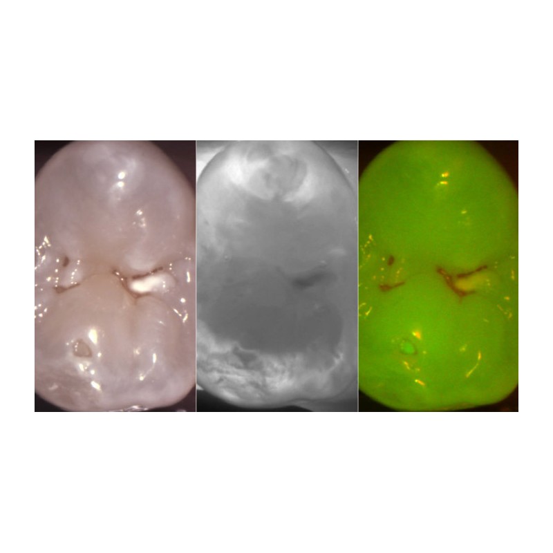 DIAGNOCAM VISION FULL HD