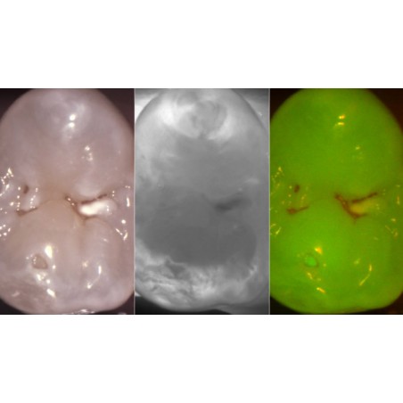 DIAGNOCAM VISION FULL HD