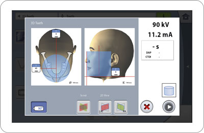 Touch Panel